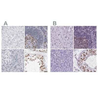 <b>Independent Antibodies Validation and Orthogonal Strategies Validation.</b>Immunohistochemistry-Paraffin: NASP Antibody [NBP2-33910] - Staining of human liver, lymph node, pancreas and testis using Anti-NASP antibody NBP2-33910 (A) shows similar protein distribution across tissues to independent antibody NBP2-33928 (B).