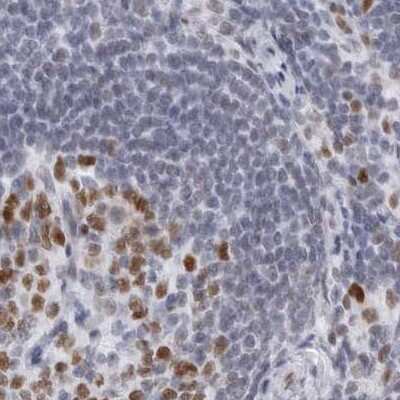 Immunohistochemistry-Paraffin: NASP Antibody [NBP2-33910] - Staining of human lymph node.