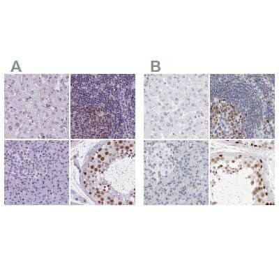 <b>Independent Antibodies Validation and Orthogonal Strategies Validation.</b>Immunohistochemistry-Paraffin: NASP Antibody [NBP2-33928] - Staining of human liver, lymph node, pancreas and testis using Anti-NASP antibody NBP2-33928 (A) shows similar protein distribution across tissues to independent antibody NBP2-33910 (B).