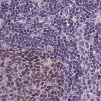 Immunohistochemistry-Paraffin: NASP Antibody [NBP2-33928] - Staining of human lymph node.