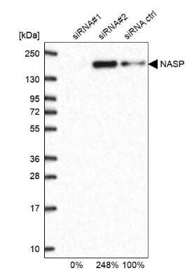 <b>Genetic Strategies Validation. </b>Western Blot: NASP Antibody [NBP2-33910] - Analysis in U2OS cells transfected with control siRNA, target specific siRNA probe #1 and #2, using anti-NASP antibody. Remaining relative intensity is presented.