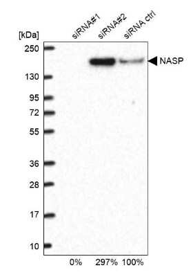 <b>Genetic Strategies Validation. </b>Western Blot: NASP Antibody [NBP2-33928] - Analysis in U2OS cells transfected with control siRNA, target specific siRNA probe #1 and #2, using anti-NASP antibody. Remaining relative intensity is presented.