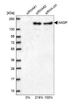 Western Blot: NASP Antibody [NBP2-33929] - Analysis in U2OS cells transfected with control siRNA, target specific siRNA probe #1 and #2, using anti-NASP antibody. Remaining relative intensity is presented.