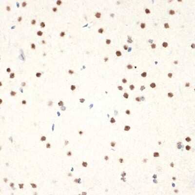 Immunohistochemistry-Paraffin NAT10 Antibody (5Z3E5)