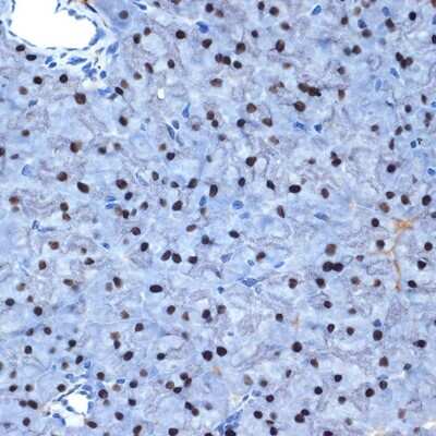 Immunohistochemistry-Paraffin: NAT10 Antibody (5Z3E5) [NBP3-15742] - Mouse pancreas using NAT10 Rabbit mAb (NBP3-15742) at dilution of 1:100 (40x lens).Perform microwave antigen retrieval with 10 mM Tris/EDTA buffer pH 9.0 before commencing with IHC staining protocol.