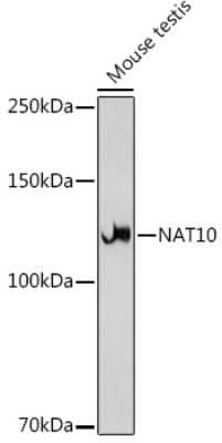 Western Blot: NAT10 Antibody (5Z3E5) [NBP3-15742] - Analysis of extracts of Mouse testis, using NAT10 antibody (NBP3-15742) at 1:1000 dilution. Secondary antibody: HRP Goat Anti-Rabbit IgG (H+L) at 1:10000 dilution. Lysates/proteins: 25ug per lane. Blocking buffer: 3% nonfat dry milk in TBST. Detection: ECL Basic Kit. Exposure time: 30s.