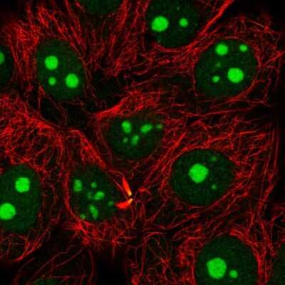 Immunocytochemistry/Immunofluorescence: NAT10 Antibody [NBP2-56861] - Staining of human cell line MCF7 shows localization to nucleoli & midbody.