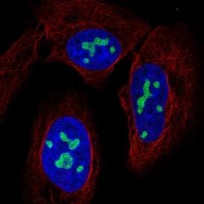 Immunocytochemistry/Immunofluorescence: NAT10 Antibody [NBP2-57390] - Staining of human cell line U-2 OS shows localization to nucleoli.