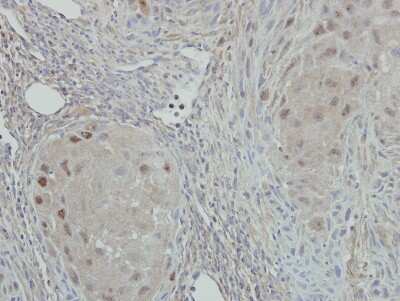 Immunohistochemistry-Paraffin: NAT10 Antibody [NBP2-15034] - Paraffin-embedded SCC4 xenograft, using antibody at 1:500 dilution.