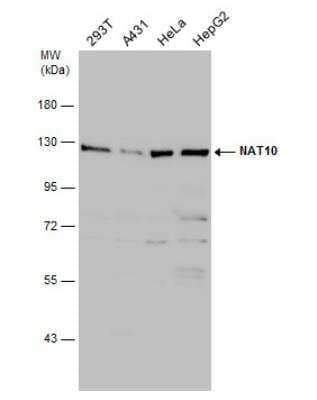 Western Blot: NAT10 Antibody [NBP2-15033] - Various whole cell extracts (30 ug) were separated by 7.5% SDS-PAGE, and the membrane was blotted with NAT10 antibody diluted at 1:1000.