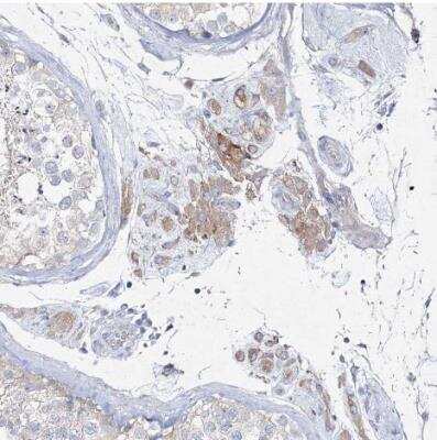 Immunohistochemistry-Paraffin NAT11 Antibody - BSA Free