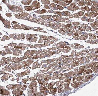 Immunohistochemistry-Paraffin NAT11 Antibody - BSA Free