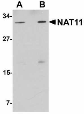 Western Blot: NAT11 Antibody [NBP1-72143] - Western blot of NAT11 in human thymus tissue lysate with NAT11 antibody at (A) 1 and (B) 2 ug/ml.