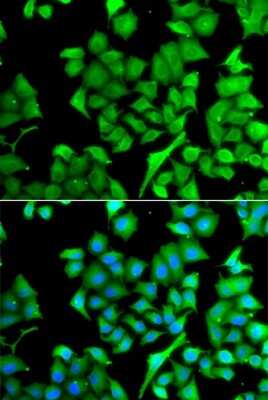 Immunocytochemistry/Immunofluorescence: NAT13 Antibody [NBP2-93076] - Immunofluorescence analysis of A549 cells using NAT13 antibody (NBP2-93076). Blue: DAPI for nuclear staining.