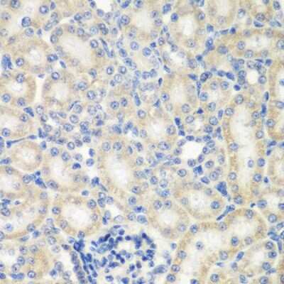 Immunohistochemistry-Paraffin: NAT13 Antibody [NBP2-93356] - Rat kidney using NAA50 antibody at dilution of 1:200 (40x lens).Perform microwave antigen retrieval with 10 mM PBS buffer pH 7.2 before commencing with IHC staining protocol.