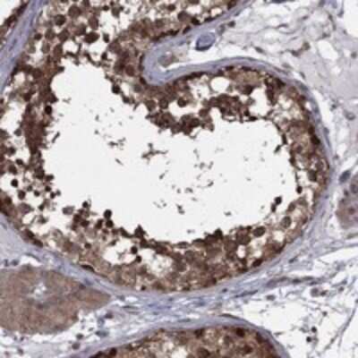 Immunohistochemistry-Paraffin: NAT13 Antibody [NBP3-17743] - Staining of human testis shows strong cytoplasmic positivity in cells in seminiferous ducts.