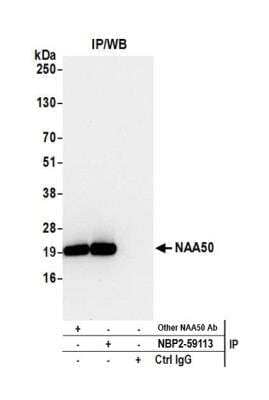 Immunoprecipitation: NAT13 Antibody [NBP2-59113] - Detection of human NAA50 by western blot of immunoprecipitates. Samples: Whole cell lysate (0.5 or 1.0 mg per IP reaction; 20% of IP loaded) from 293T cells prepared using NETN lysis buffer. Antibodies: Affinity purified rabbit anti-NAA50 antibody NBP2-59113 used for IP at 20 ul per reaction. NAA50 was also immunoprecipitated by another rabbit anti-NAA50 antibody. For blotting immunoprecipitated NAA50, NBP2-59113 was used at 1:250. Detection: Chemiluminescence with an exposure time of 10 seconds.