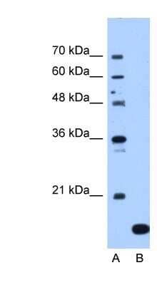 Western Blot: NAT13 Antibody [NBP1-55172] - Titration: 1.25ug/ml Positive Control: Jurkat cell lysate.