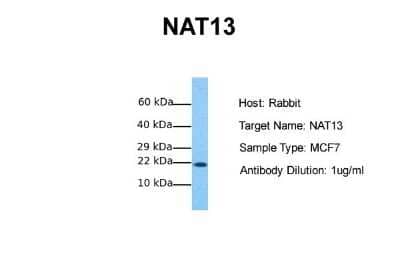 Western Blot: NAT13 Antibody [NBP1-55172] - Sample Tissue: Human MCF7 Antibody Dilution: 1.0 ug/ml