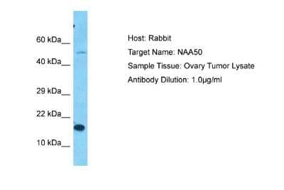 Western Blot: NAT13 Antibody [NBP2-86724] - Host: Rabbit. Target Name: NAA50. Sample Type: Ovary Tumor lysates. Antibody Dilution: 1.0ug/ml