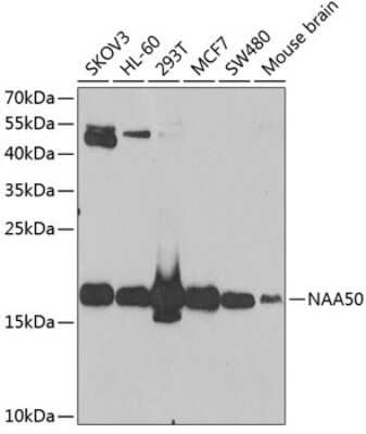 Western Blot: NAT13 Antibody [NBP2-93076] - Analysis of extracts of various cell lines, using NAT13 .Exposure time: 90s.