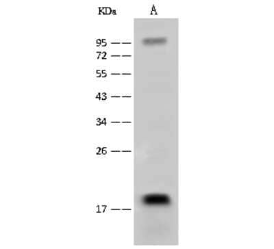 Western Blot: NAT13 Antibody [NBP2-99510] - Anti-NAT13 rabbit polyclonal antibody at 1:500 dilution. Lane A: K562 Whole Cell Lysate Lysates/proteins at 30 ug per lane. Secondary Goat Anti-Rabbit IgG (H+L)/HRP at 1/10000 dilution. Developed using the ECL technique. Performed under reducing conditions. Predicted band size: 19 kDa. Observed band size: 19 kDa