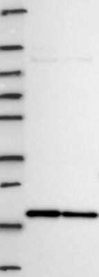 Western Blot: NAT13 Antibody [NBP3-17743] - Lane 1: Marker [kDa] 250, 130, 95, 72, 55, 36, 28, 17, 10;   Lane 2: RT4;   Lane 3: U-251 MG