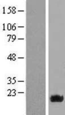 Western Blot: NAT13 Overexpression Lysate (Adult Normal) [NBL1-13487] Left-Empty vector transfected control cell lysate (HEK293 cell lysate); Right -Over-expression Lysate for NAT13.