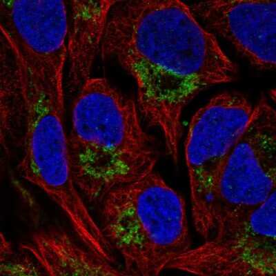 Immunocytochemistry/ Immunofluorescence NAT14 Antibody - BSA Free