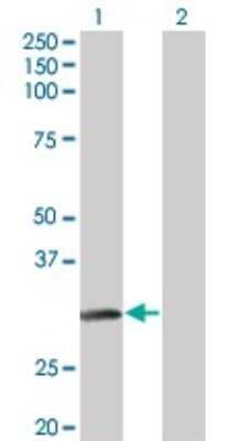 Western Blot: NAT2 Antibody (3B5) [H00000010-M01] - Analysis of NAT2 expression in transfected 293T cell line by NAT2 monoclonal antibody (M01), clone 3B5.Lane 1: NAT2 transfected lysate(33.5 KDa).Lane 2: Non-transfected lysate.