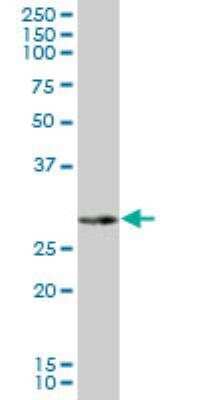 Western Blot: NAT2 Antibody [H00000010-B01P] - Analysis of NAT2 expression in human liver.