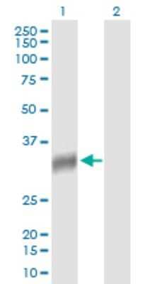 Western Blot: NAT2 Antibody [H00000010-B01P] - Analysis of NAT2 expression in transfected 293T cell line by NAT2 polyclonal antibody.  Lane 1: NAT2 transfected lysate(31.9 KDa). Lane 2: Non-transfected lysate.