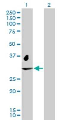 Western Blot: NAT2 Antibody [H00000010-D01P] - Analysis of NAT2 expression in transfected 293T cell line by NAT2 polyclonal antibody.Lane 1: NAT2 transfected lysate(33.50 KDa).Lane 2: Non-transfected lysate.