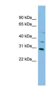 Western Blot: NAT2 Antibody [NBP1-59526] - HepG2 cell lysate, Antibody Titration: 0.2-1 ug/ml