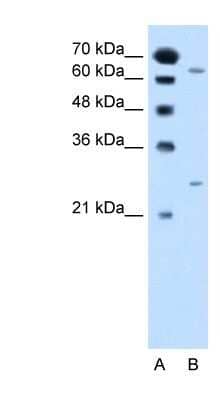 Western Blot: NAT2 Antibody [NBP1-59905] - Jurkat cell lysate, Antibody Titration: 2.5ug/ml