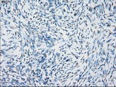 Immunohistochemistry: NAT8 Antibody (OTI5A8) - Azide and BSA Free [NBP2-72878] - Staining of paraffin-embedded Ovary tissue using anti-NAT8 mouse monoclonal antibody.