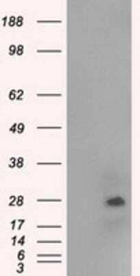 Western Blot: NAT8 Antibody (OTI5A8) - Azide and BSA Free [NBP2-72878] - HEK293T cells were transfected with the pCMV6-ENTRY control (Left lane) or pCMV6-ENTRY NAT8 (Right lane) cDNA for 48 hrs and lysed. Equivalent amounts of cell lysates (5 ug per lane) were separated by SDS-PAGE and immunoblotted with anti-NAT8.