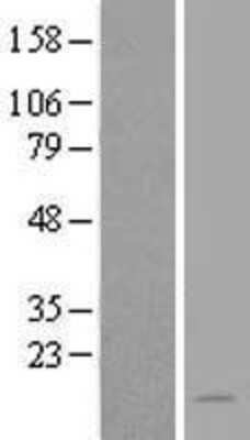 Western Blot NAT8L Overexpression Lysate