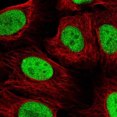 Immunocytochemistry/Immunofluorescence: NAT9 Antibody [NBP2-58039] - Staining of human cell line U-2 OS shows localization to nucleoplasm.