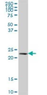 Western Blot NAT9 Antibody - Azide and BSA Free