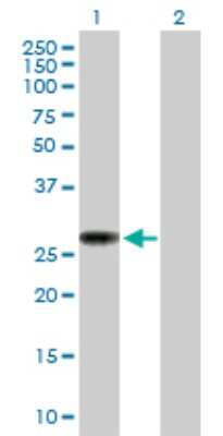 Western Blot: NAT9 Antibody [H00026151-B01P] - Analysis of NAT9 expression in transfected 293T cell line by NAT9 polyclonal antibody.  Lane 1: NAT9 transfected lysate(22.77 KDa). Lane 2: Non-transfected lysate.