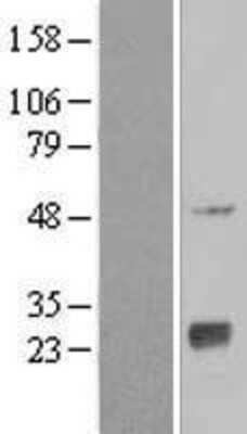 Western Blot: NAT9 Overexpression Lysate (Adult Normal) [NBL1-13494] Left-Empty vector transfected control cell lysate (HEK293 cell lysate); Right -Over-expression Lysate for NAT9.