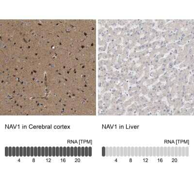 Immunohistochemistry-Paraffin NAV1 Antibody