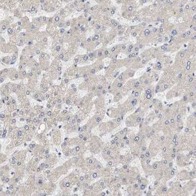 Immunohistochemistry-Paraffin: NAV1 Antibody [NBP1-84083] - Staining of human liver shows very weak cytoplasmic positivity in hepatocytes.