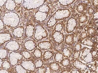 Immunohistochemistry-Paraffin: NAV1 Antibody [NBP3-06303] - Immunochemical staining of human NAV1 in human stomach with rabbit polyclonal antibody at 1:100 dilution, formalin-fixed paraffin embedded sections.