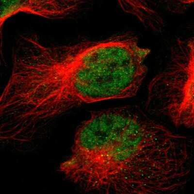 Immunocytochemistry/ Immunofluorescence NAV2 Antibody