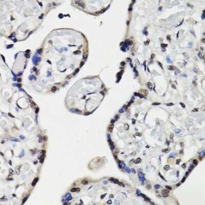 Immunohistochemistry-Paraffin: NAV2 Antibody [NBP3-04796] - Paraffin-embedded human placenta using NAV2 antibody at dilution of 1:100 (40x lens).