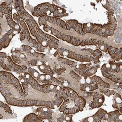 Immunohistochemistry-Paraffin NAV3 Antibody - BSA Free