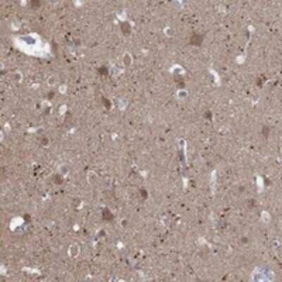 Immunohistochemistry-Paraffin NAV3 Antibody - BSA Free