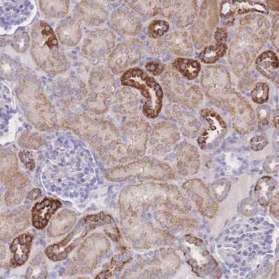 Immunohistochemistry-Paraffin: NBEAL1 Antibody [NBP2-33568] - Staining of human kidney shows strong cytoplasmic positivity in cells in tubules.